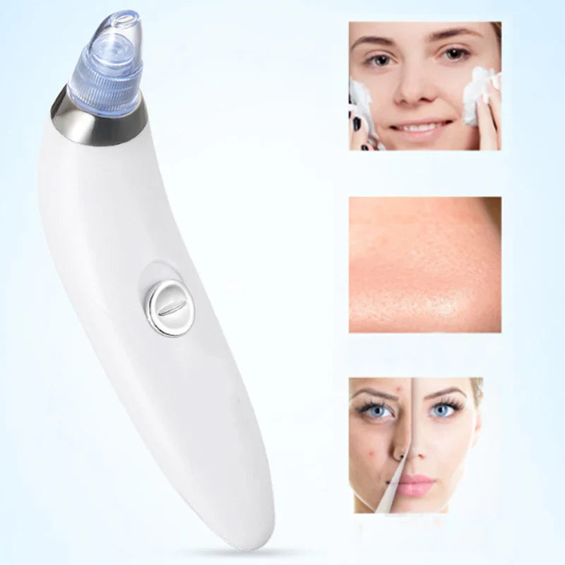 Blackhead and Acne Suction & PoresCleaner