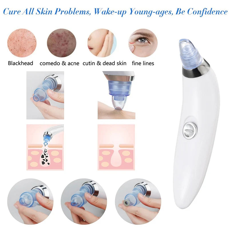 Blackhead and Acne Suction & PoresCleaner